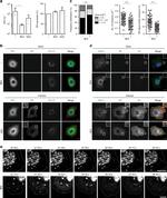 PDI Antibody in Immunocytochemistry (ICC/IF)