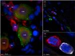 IBA1 Antibody in Immunohistochemistry (IHC)