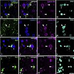 Lamin B2 Antibody in Immunohistochemistry (IHC)