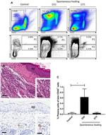 CD138 Antibody in Immunohistochemistry (IHC)