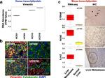 Cytokeratin Pan Antibody in Immunohistochemistry (IHC)