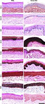 Collagen I Antibody in Immunohistochemistry (IHC)