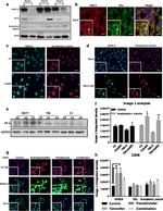 Acetyl-alpha Tubulin (Lys40) Antibody in Immunocytochemistry (ICC/IF)