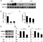 SRC3 Antibody in Western Blot (WB)