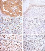 KIAA1429 Antibody in Immunocytochemistry, Immunohistochemistry (ICC/IF, IHC)