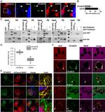 GFP Antibody in Immunocytochemistry (ICC/IF)