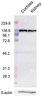 Calcium Sensing Receptor Antibody in Western Blot (WB)