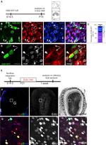 FOXJ1 Antibody in Immunohistochemistry (IHC)