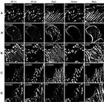 FAK Antibody in Immunocytochemistry (ICC/IF)