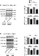 FAK Antibody in Western Blot (WB)