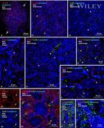 Connexin 43 Antibody in Immunohistochemistry (IHC)