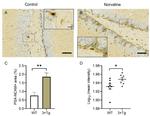 PSA-NCAM Antibody in Immunohistochemistry (IHC)