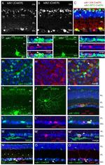 Opsin 4 Antibody in Immunocytochemistry, Immunohistochemistry (ICC/IF, IHC)