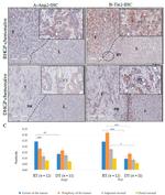 TEK Antibody in Immunohistochemistry (IHC)