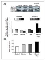 FKBP5 Antibody in Western Blot (WB)