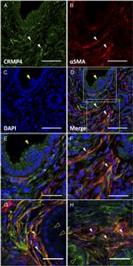 Alpha-Smooth Muscle Actin Antibody in Immunohistochemistry (IHC)