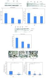 IKK gamma Antibody in Western Blot, Immunohistochemistry (WB, IHC)