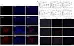 Arginase 1 Antibody in Immunocytochemistry (ICC/IF)