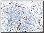 CD34 Antibody in Immunohistochemistry (IHC)