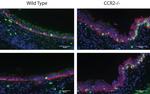 Ki-67 Antibody in Immunohistochemistry (IHC)