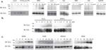 Acetylated Lysine Antibody in Western Blot (WB)