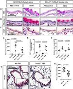 MUC5AC Antibody in Immunohistochemistry (IHC)