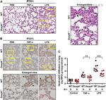 CD54 (ICAM-1) Antibody in Immunohistochemistry (IHC)