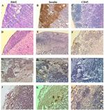 CD45 Antibody in Immunohistochemistry (IHC)