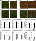 VGLUT1 Antibody in Immunohistochemistry (IHC)