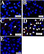 Vinculin Antibody in Proximity Ligation Assay (PLA) (PLA)