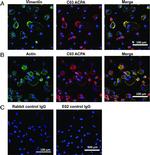 Vimentin Antibody in Immunocytochemistry (ICC/IF)