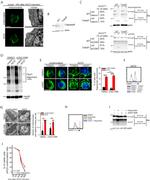 CD3 Antibody in T-Cell Activation (TCA)