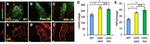 CD8a Antibody in Immunohistochemistry (IHC)