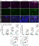 CD8a Antibody in Immunohistochemistry (IHC)