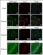 GFAP Antibody in Immunohistochemistry (IHC)