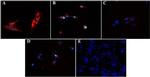 Desmoglein 1 Antibody in Immunocytochemistry (ICC/IF)