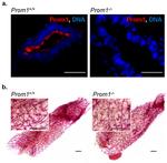 CD133 (Prominin-1) Antibody in Immunohistochemistry (IHC)