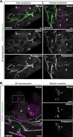 Podoplanin Antibody in Immunocytochemistry (ICC/IF)