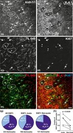 Ki-67 Antibody in Immunocytochemistry (ICC/IF)