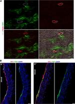 Thrombospondin 1 Antibody in Immunohistochemistry (IHC)