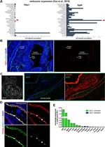 Thrombospondin 1 Antibody in Immunohistochemistry (IHC)