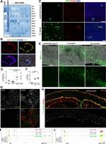 Thrombospondin 1 Antibody in Immunohistochemistry (IHC)