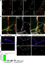 Claudin 5 Antibody in Immunohistochemistry (IHC)