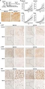 Ki-67 Antibody in Immunohistochemistry (IHC)