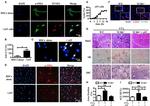 TCR gamma/delta Antibody in Immunocytochemistry (ICC/IF)