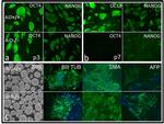 Nanog Antibody in Immunocytochemistry (ICC/IF)