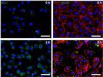 EEA1 Antibody in Immunocytochemistry (ICC/IF)