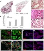 FOXJ1 Antibody in Immunohistochemistry (IHC)