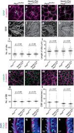 FOXJ1 Antibody in Immunocytochemistry, Immunohistochemistry (ICC/IF, IHC)