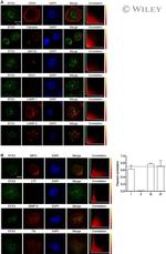 MMP9 Antibody in Immunocytochemistry (ICC/IF)